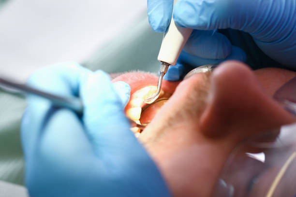 Best Broken Tooth Emergency  in Stanaford, WV