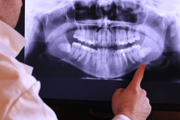 Best Chipped Tooth Repair Near Me  in Stanaford, WV