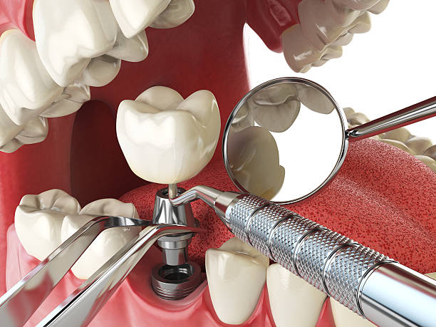 Best Cracked Tooth Emergency Dentist  in Stanaford, WV